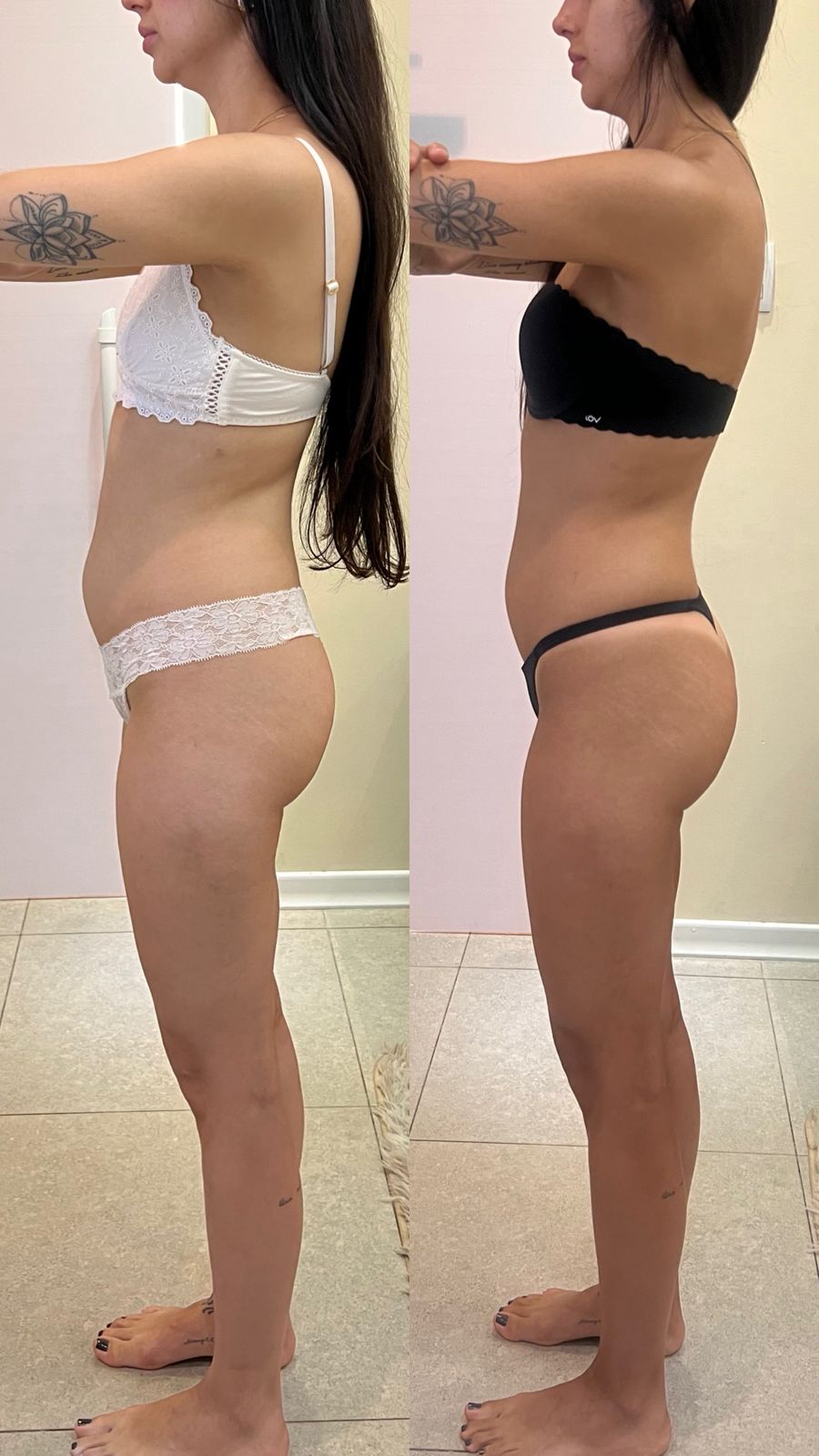 Fotos Antes e Depois